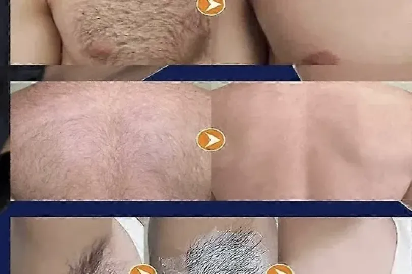 Waxing-Haarentfernung, Switzerland